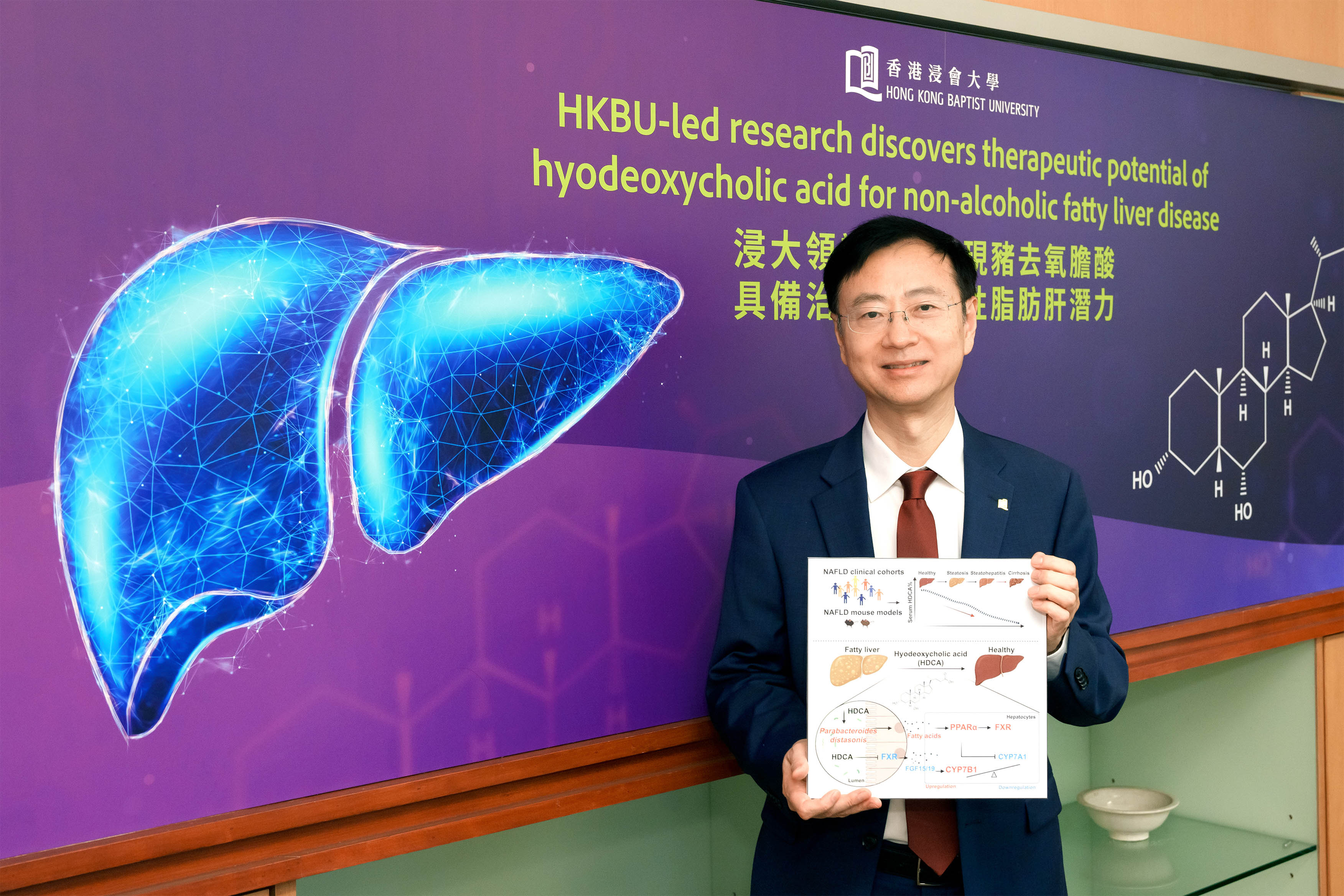 A research led by Professor Jia Wei, Acting Dean and Chair Professor in Chinese Medicine and Systems Biology of the School of Chinese Medicine at HKBU, discovers that hyodeoxycholic acid offers promising potential as a pharmaceutical intervention for non-alcoholic fatty liver disease.